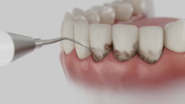 Trusted Root Canal Treatment service in Drum Point, MD - Dentist Open Now